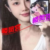 柳州城中区䒕艾